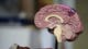 The Future of AI in Healthcare