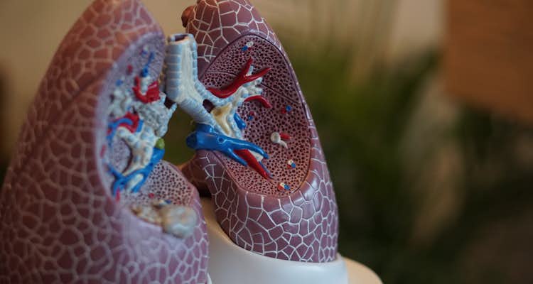 Tromboembolismo pulmonar em pacientes com COVID-19: um estudo de coorte francês multicêntrico 