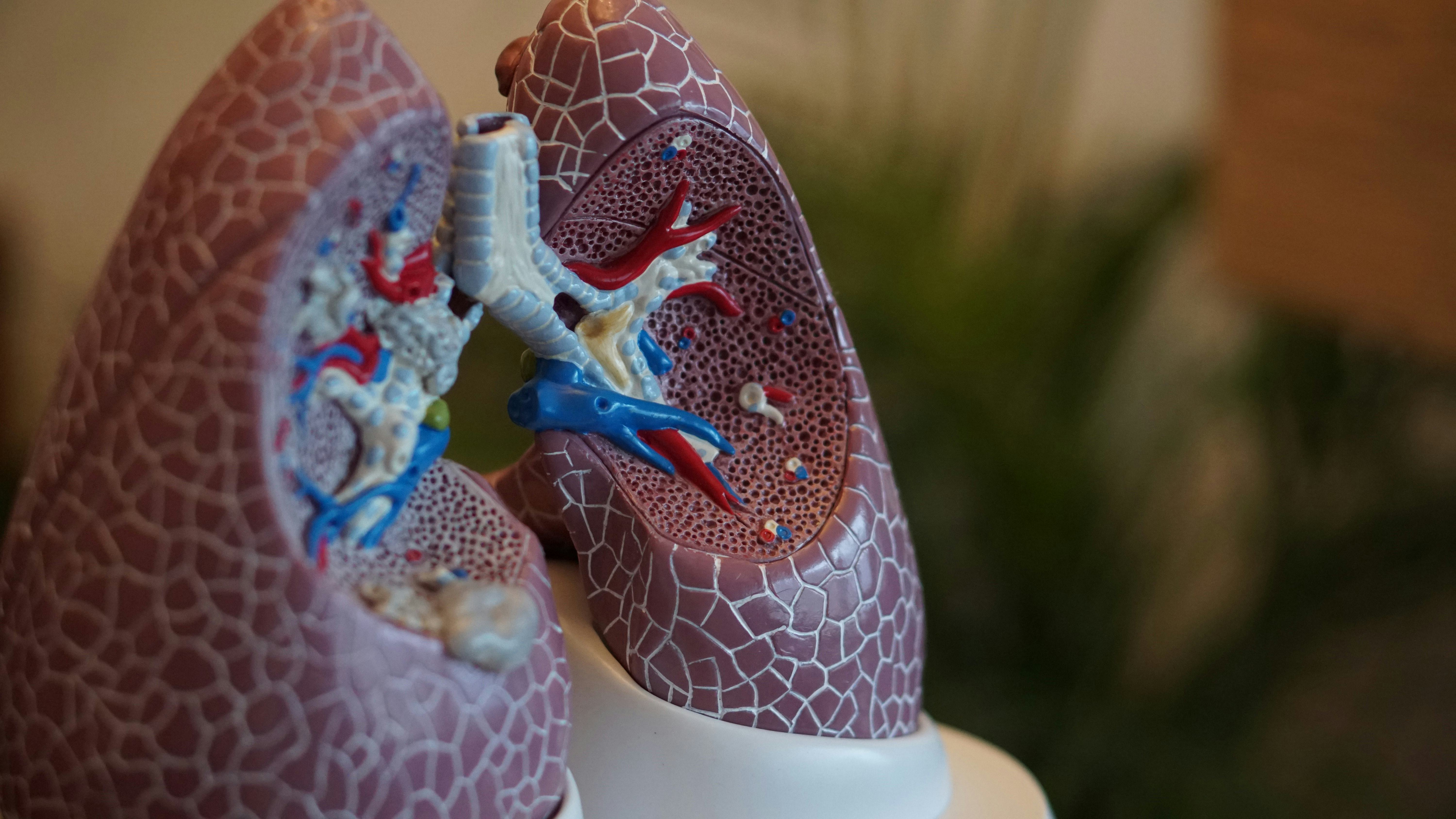 Tromboembolismo pulmonar em pacientes com COVID-19: um estudo de coorte francês multicêntrico 