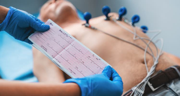 Eletrocardiograma: como diferenciar embolia de pulmão de síndrome coronariana aguda