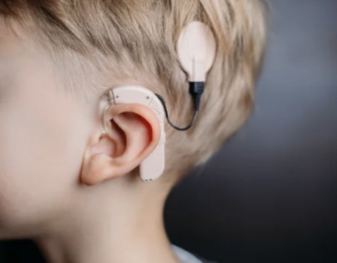 A triagem auditiva universal impacta o diagnóstico e início do tratamento da deficiência auditiva?