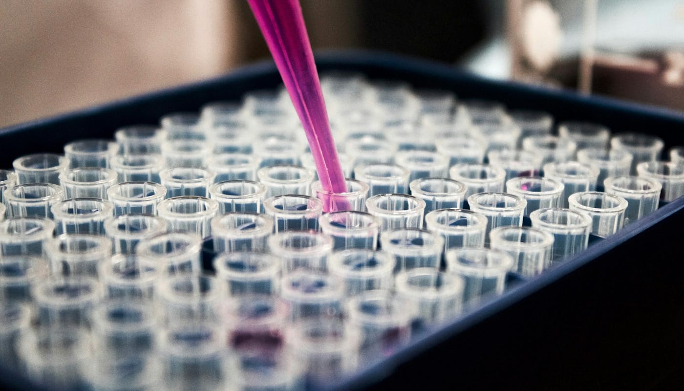 What the Latest Long COVID Biomarker Study Actually Shows