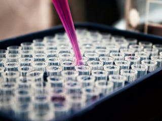 What the Latest Long COVID Biomarker Study Actually Shows